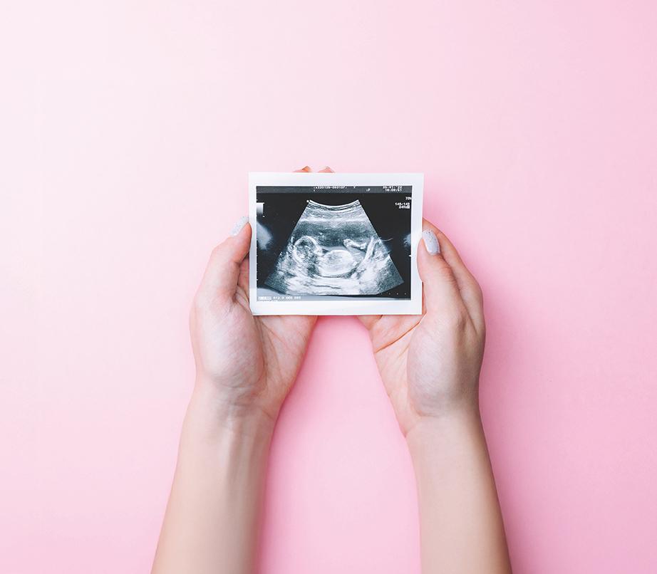 hands holding an image from an ultrasound against a pink background